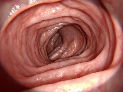 Im Dickdarm sind der Großteil unserer Darmbakterien angesiedelt. Außerdem befinden sich in der Schleimhaut dieses Darmabschnitts rund 80% unserer Immunzellen.