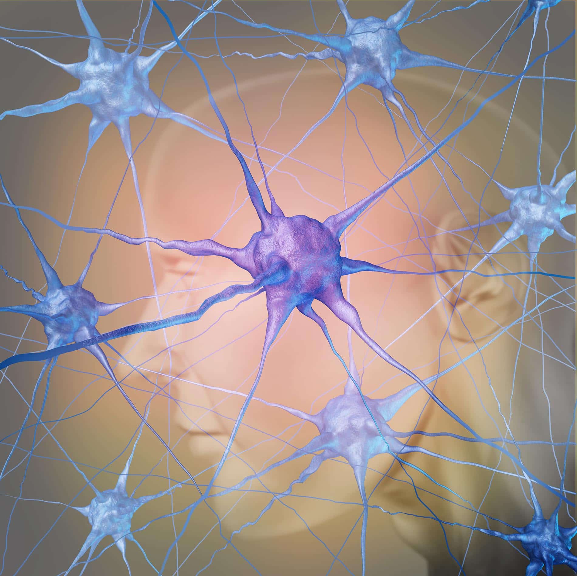 Auch unser Gehirn kann durch Entzündungen im Nervengeflecht Schaden erleiden, unter anderem gibt es inzwischen Hinweise auf Zusammenhänge mit Demenzerkrankungen.