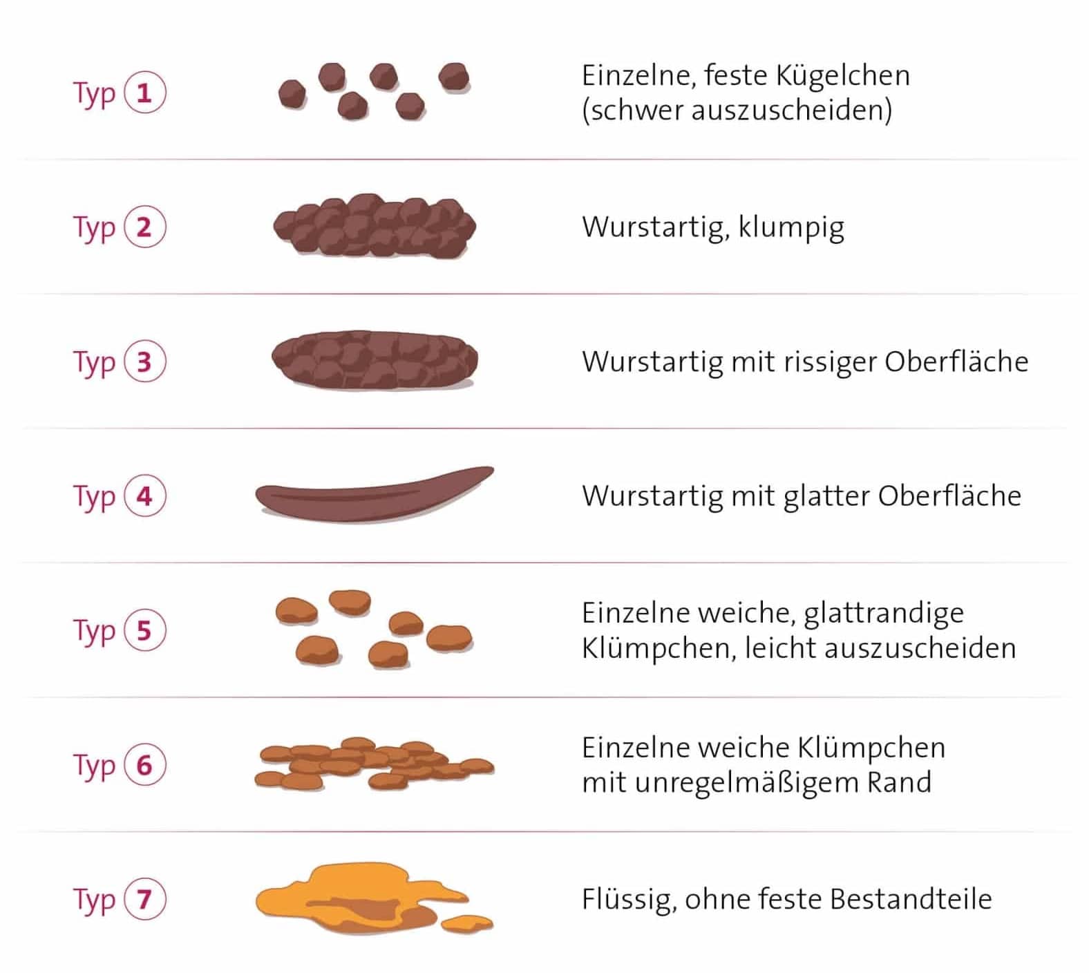 Typ 5, 6, 7 zeigt die typischen Formen des Stuhls bei Durchfall.